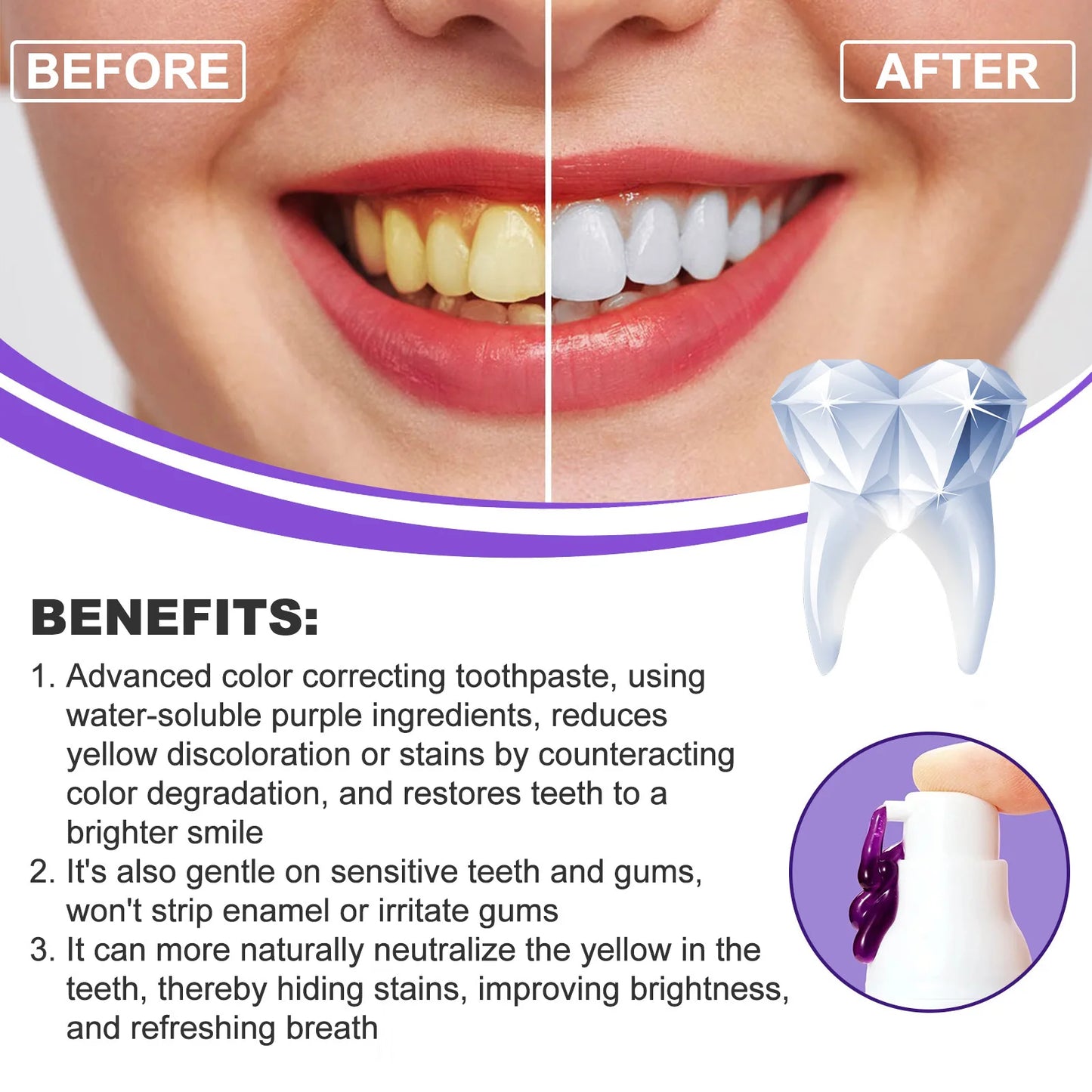 Before and after comparison of teeth with a toothpaste product, highlighting benefits.