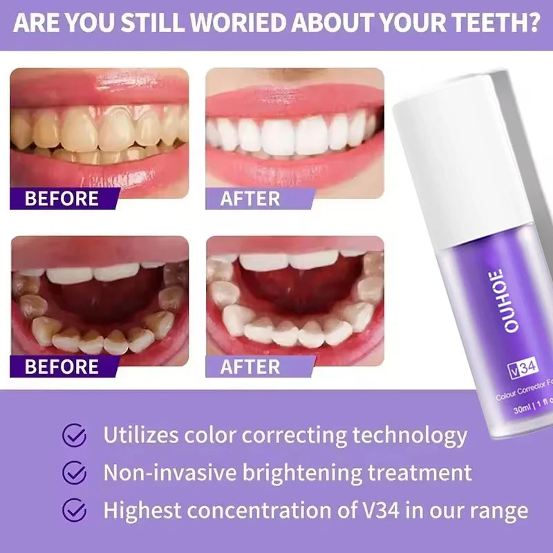 Teeth whitening product with 'before' and 'after' images on a purple background