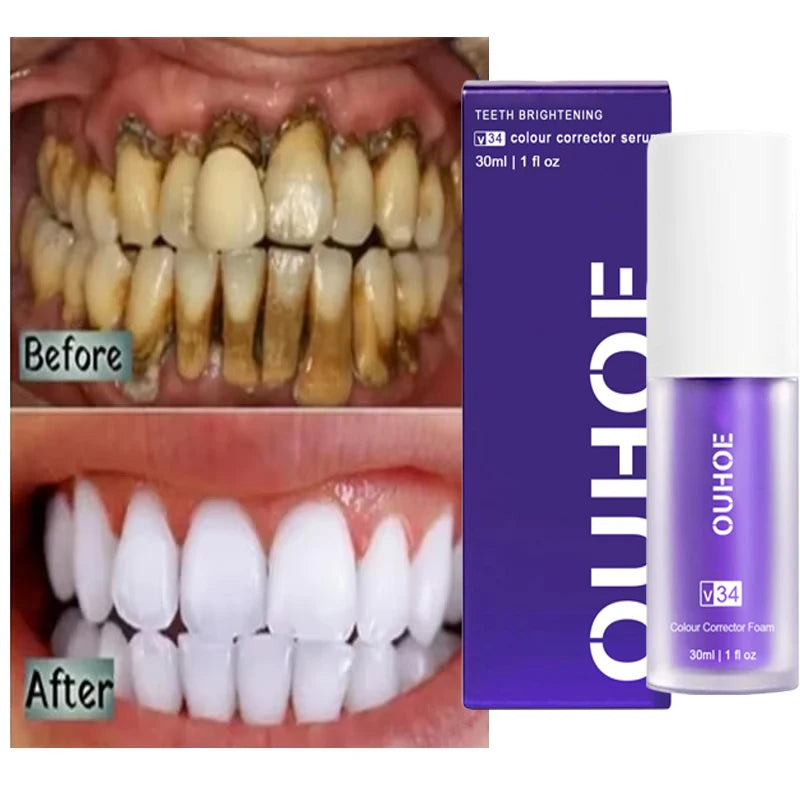 Teeth whitening product with 'Before' and 'After' tooth visuals and OUHOE branding.