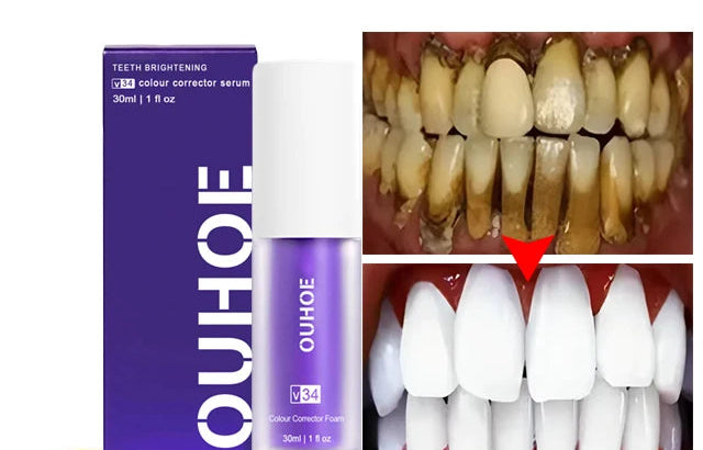 OUHOE teeth whitening product with before and after images of teeth, 15 days fast delivery text, and 24-hour fast shipment graphic.