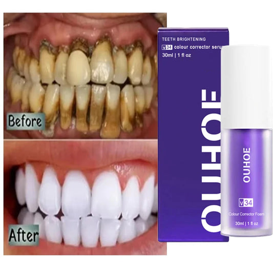Teeth whitening product with 'Before' and 'After' tooth visuals and OUHOE branding.